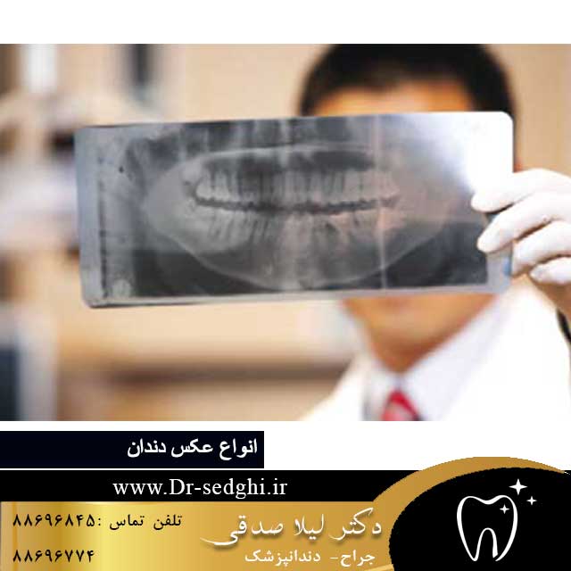 انواع عکس دندان