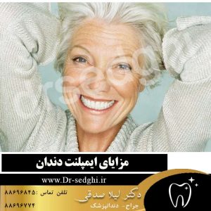 مزایای ایمپلنت دندانی