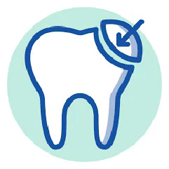 باندینگ دندان چیست؟