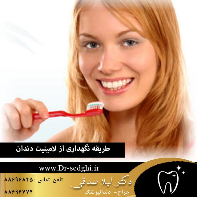 طریقه نگهداری از لامینیت دندان