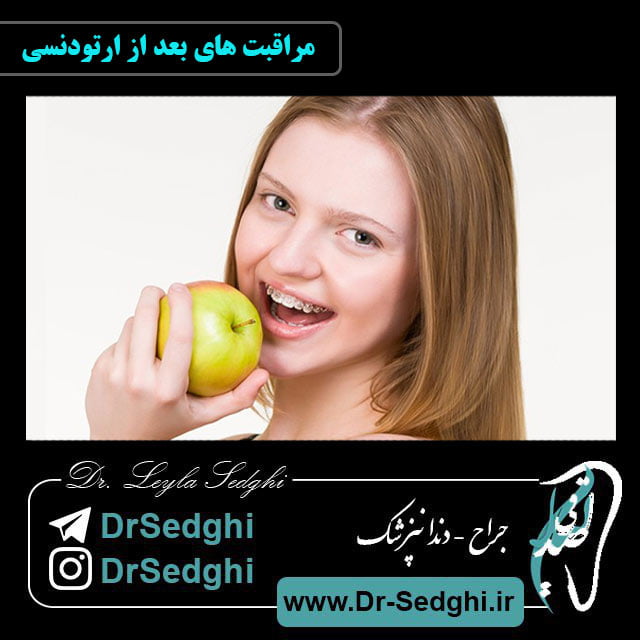 مراقبت های بعد از ارتودنسی