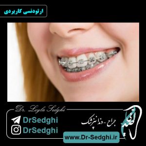 ارتودنسی کاربردی