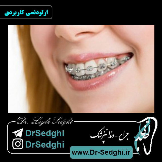 ارتودنسی کاربردی