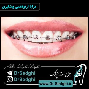 مزایا ارتودنسی پیشگیری