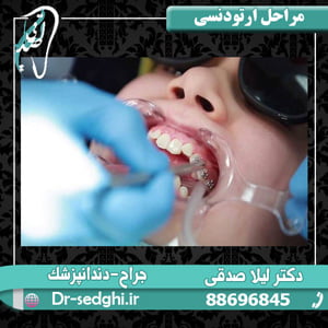 مراحل ارتودنسی