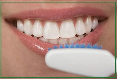مراقبت های بعد از روکش کامپوزیت دندان چیست؟
