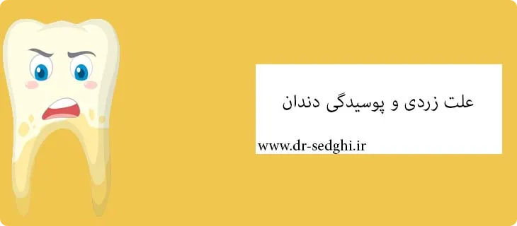 علت زردی دندان چیست