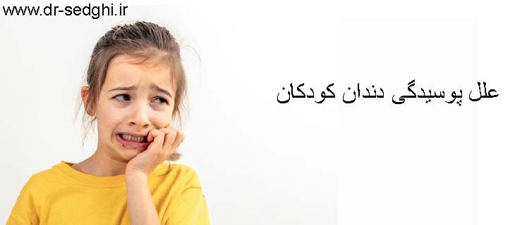پوسیدگی دندان کودکان